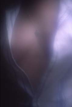 FR20050301008