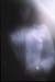 FR20050301009